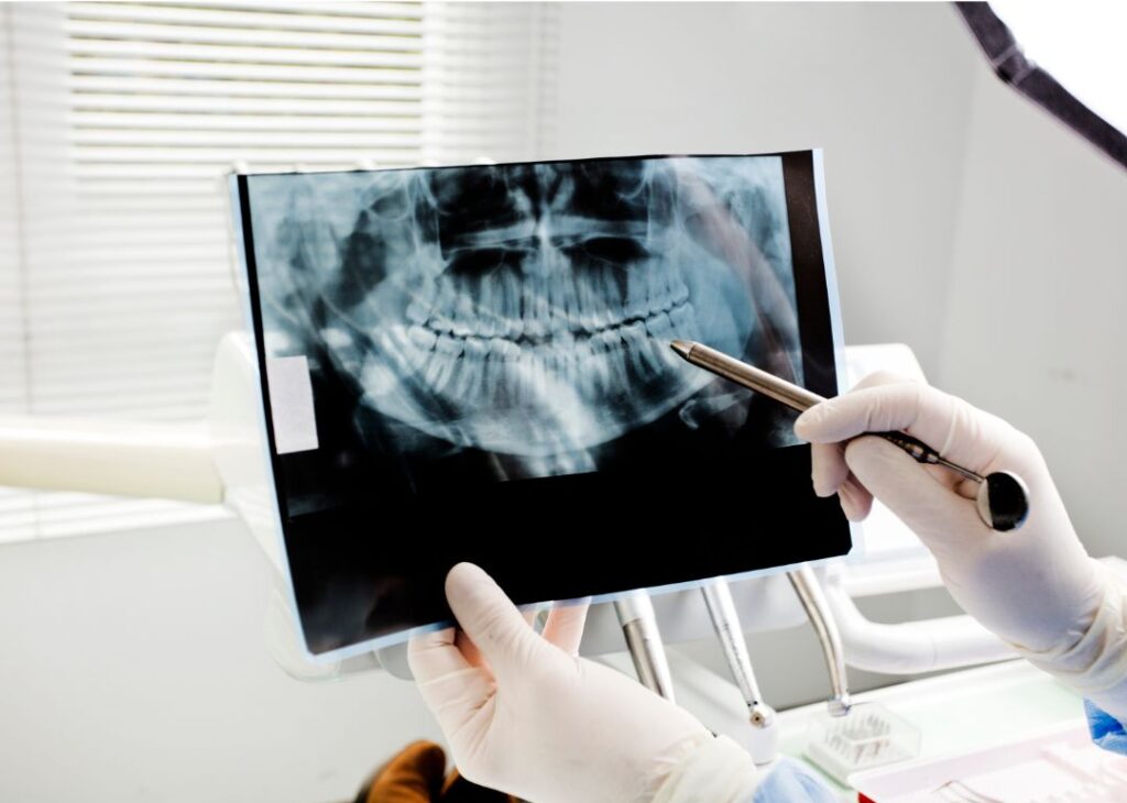 Regeneración ósea dental